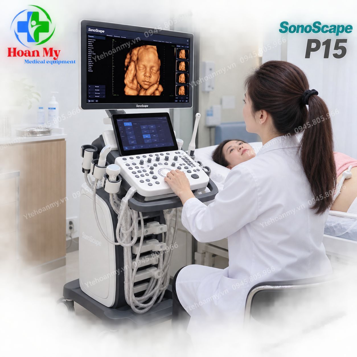 Máy siêu âm 5D Sonoscape P15, Công nghệ Mỹ, BH 2 năm